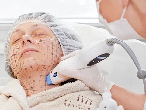 Trẻ hóa làn da từ sâu bên trong với công nghệ Thermage