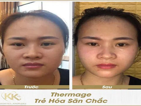Bác sĩ Ngô Kiều Khanh: 'Thị trường làm đẹp hỗn loạn, không nên ham rẻ mà rước họa vào thân'