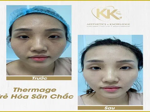 Bác sĩ Ngô Kiều Khanh lý giải tại sao bạn nên can thiệp da lão hóa bằng công nghệ Thermage