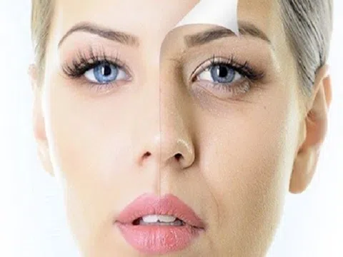 7 mẹo ngăn ngừa quầng mắt thâm đen