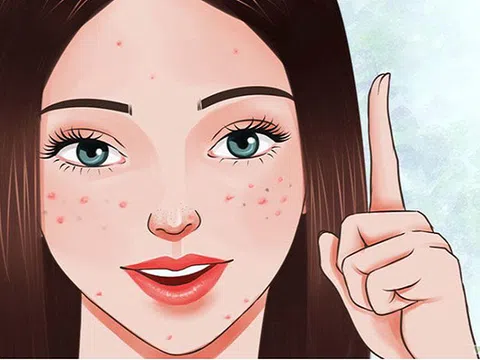 Nắm chắc 7 nguyên tắc khi chọn mỹ phẩm chăm sóc da mụn