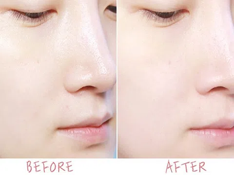 Lười đến mấy da vẫn đẹp lên trông thấy, bí kíp nằm ở chai Nước thần hoa cúc 2in1 Cỏ Cây Hoa Lá