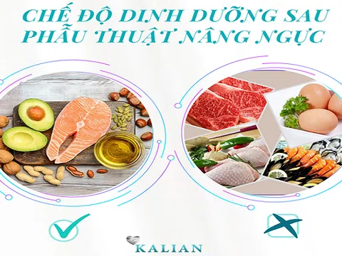 Phẫu thuật thẩm mỹ nâng ngực duy trì được bao lâu?