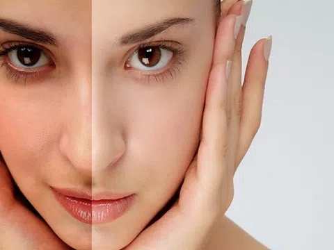 10 nguyên nhân khiến làn da bị xỉn màu