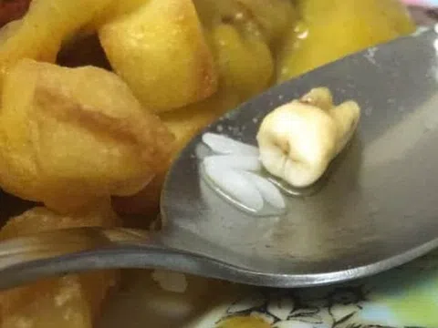 Mỹ: Kinh hoàng phát hiện răng người trong món cà ri của Trung Quốc